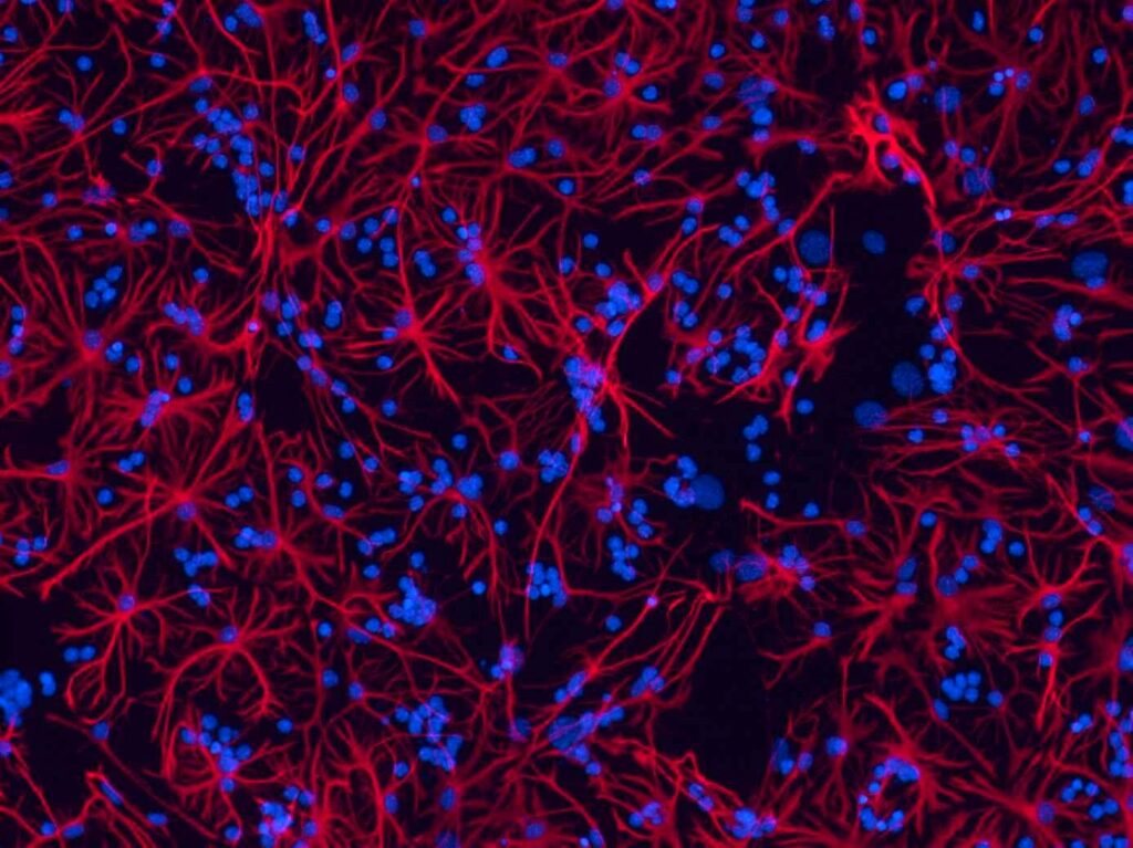 The pictures shows stained nerve cells. The cell nuclei appear as bue dots, red protusions extend in all directions.