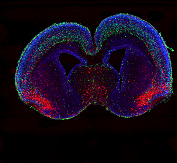 A stained section of a mouse brain. Certain areas are highlighted in red, blue or green.