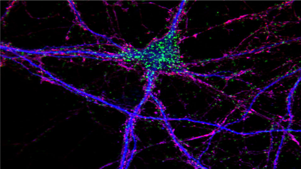 A neuron with proteins stained in different colors