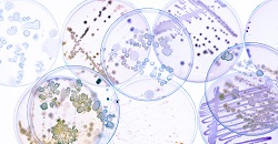 Growing Bacteria in Petri Dishes on agar gel Scientific experime